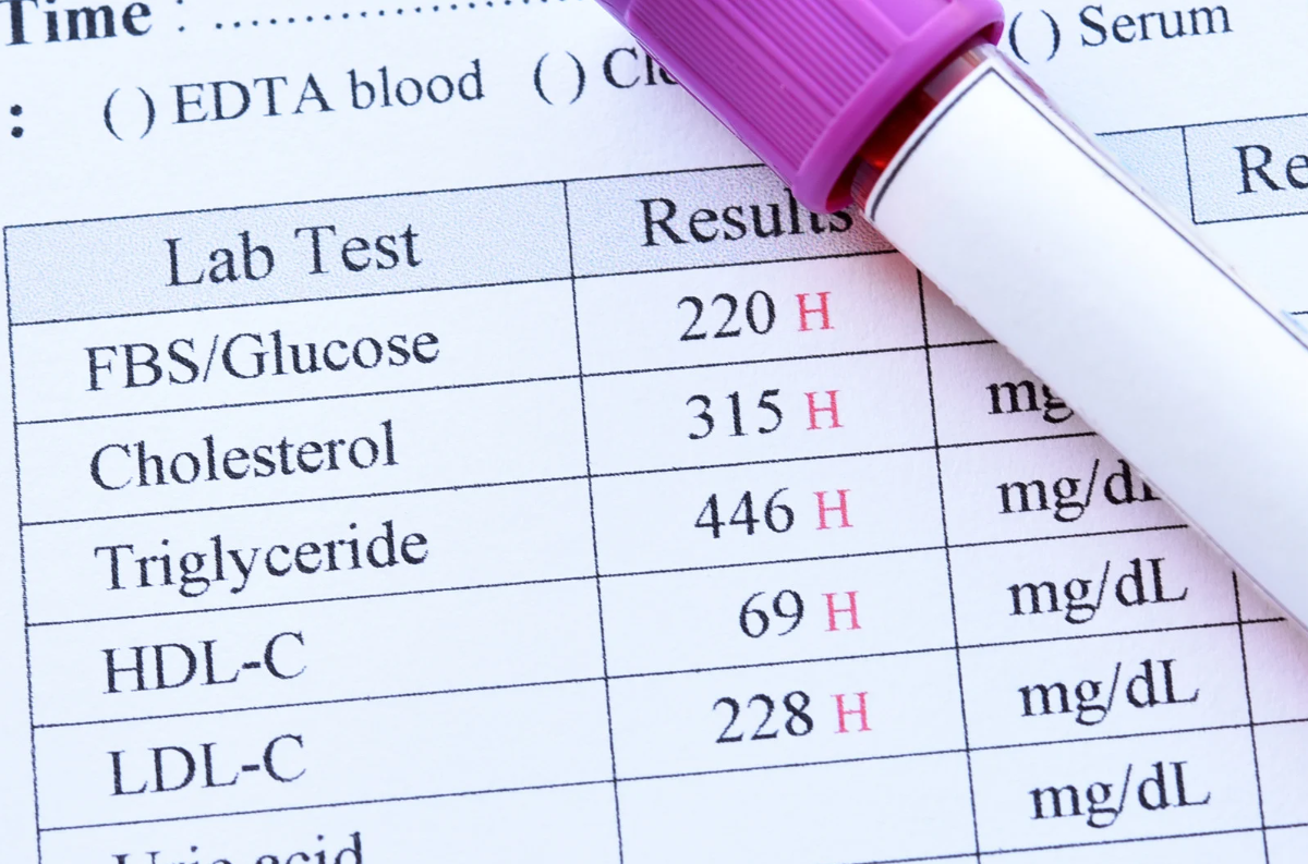 How TRT monitoring works